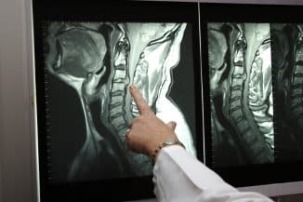 Radiografia do pescoço