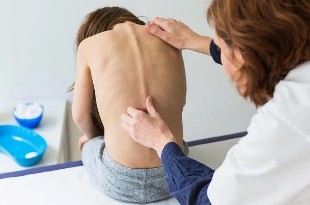 Osteocondrose costas