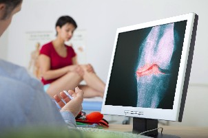 o diagnóstico de osteoartrite