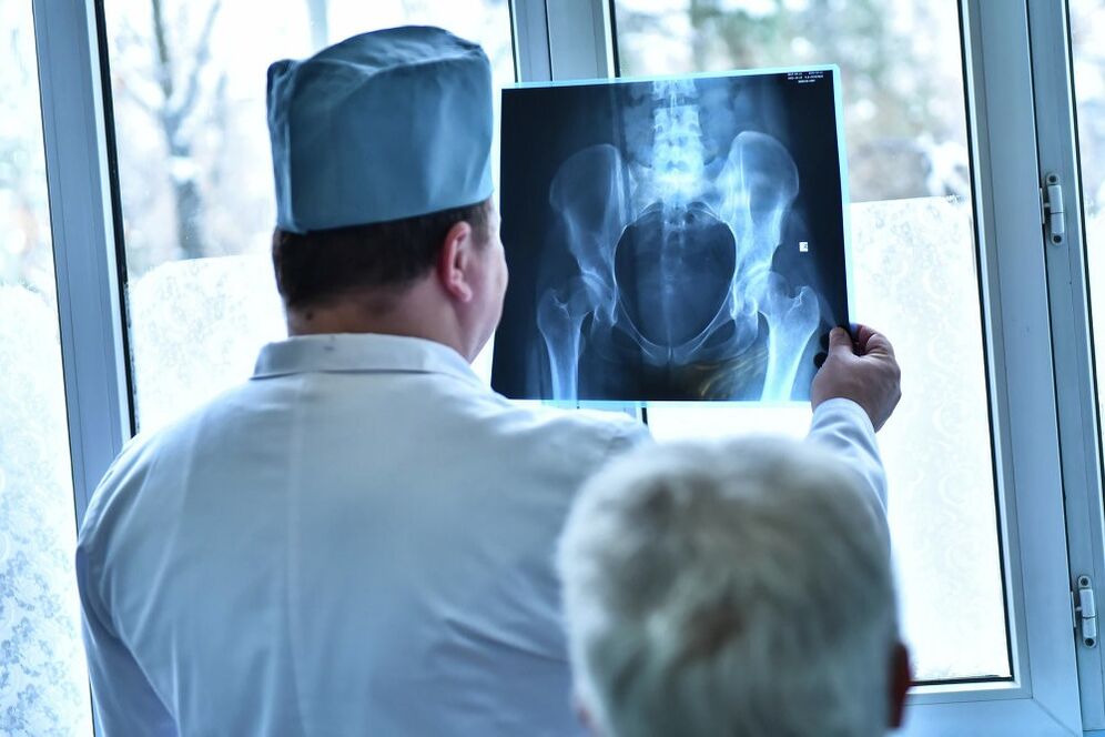 O médico olha a foto de uma articulação do quadril com artrose
